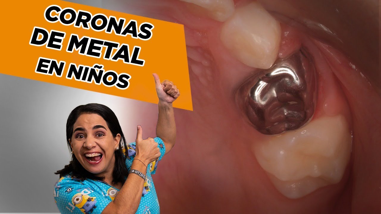 Watch Coronas Metálicas en Niños ¿SÍ o NO Now Coronas Metálicas en Niños ¿SÍ o NO