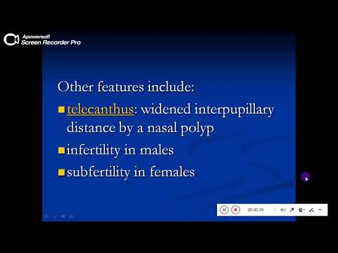 Quiz powerpoint video - case 180 - Refresh your knowledge