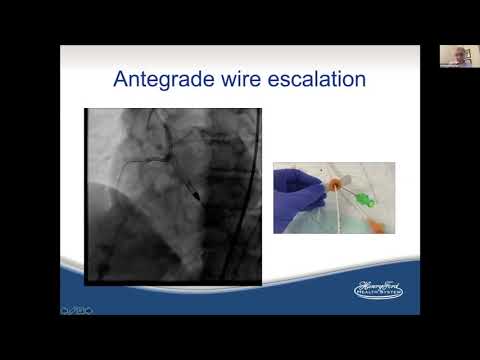 Coronary CTO PCI: Still the last frontier? CVI 2020 CME Webcast Series