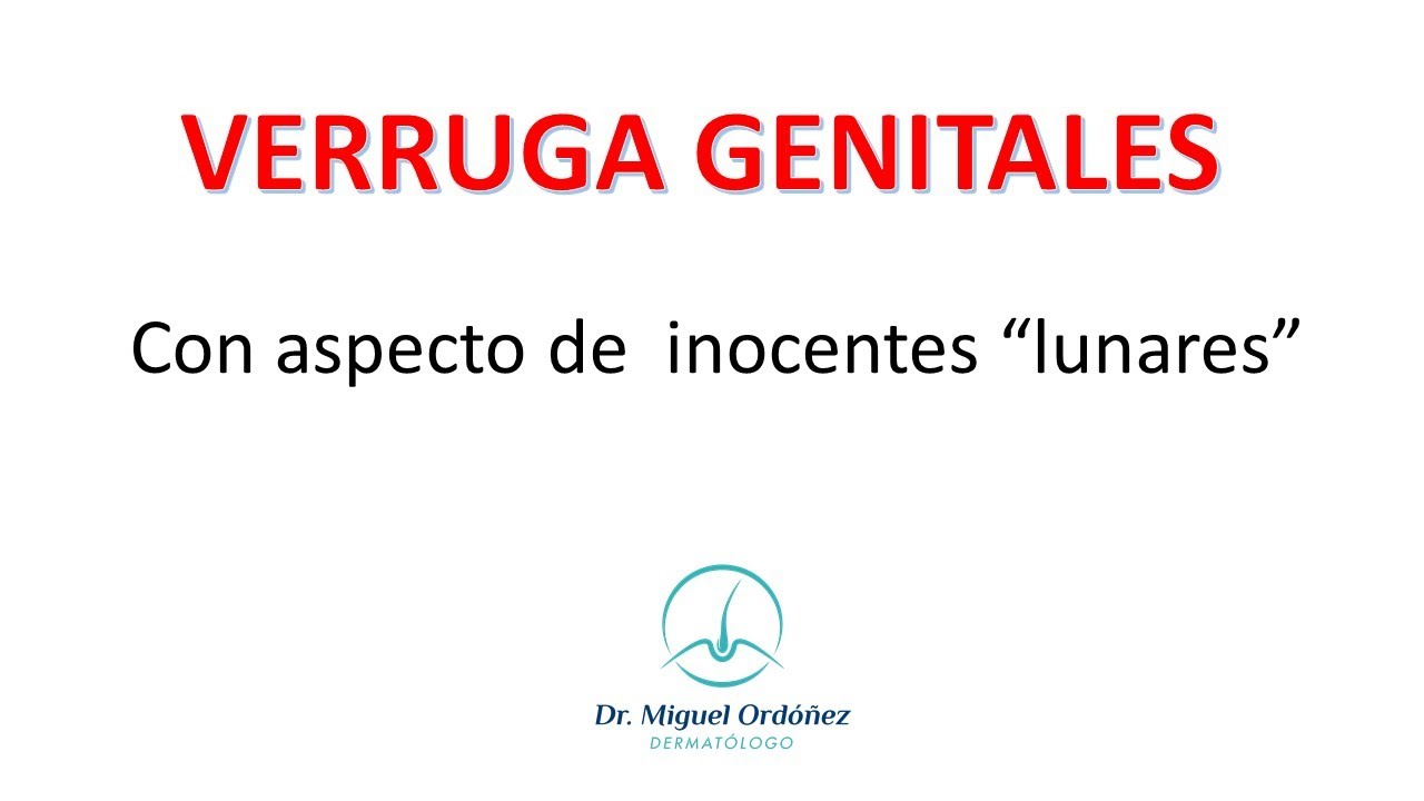 Verrugas venéreas con aspecto de inocentes lunares.
