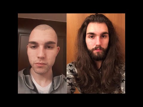 How I became Jesus Part 2 (3 year hair growth timelapse)