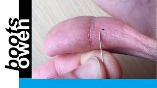 Quick and easy way to remove a stubborn thorn or splinter in your finger