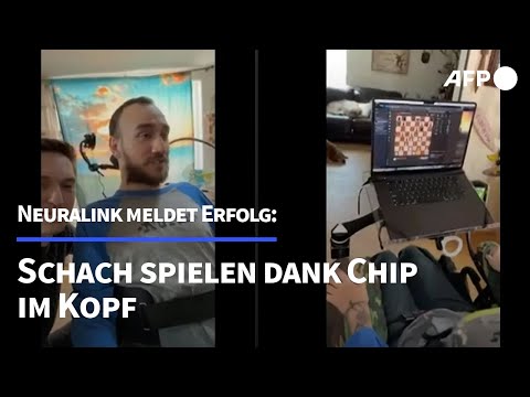 Schach spielen dank Chip im kopf | AFP