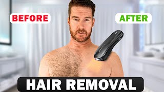 At Home Laser Hair Removal That Works? | ULike X IPL Device Full Review & Results