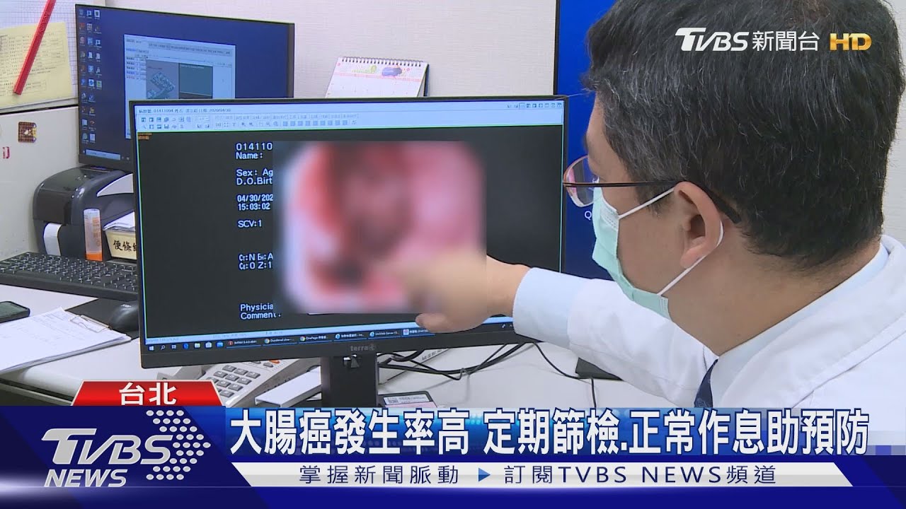 大腸癌發生率高 定期篩檢、正常作息助預防
