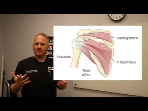 Winging Scapula Explained