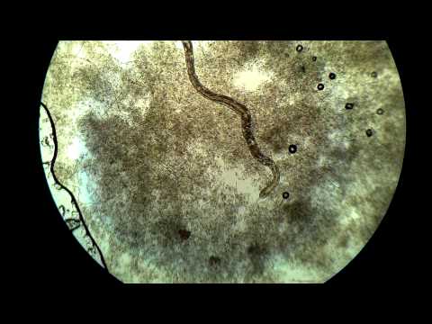 Annelid- Evolution & Diversity