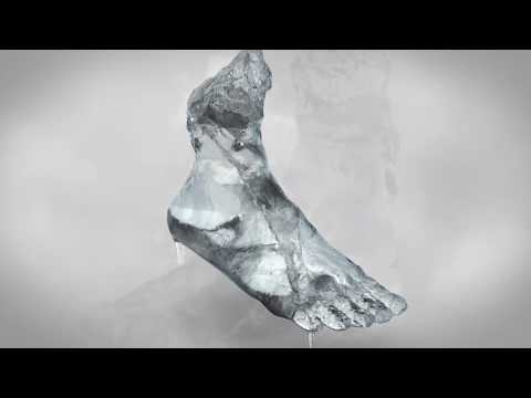 Symptoms of Vascular Disease | Cold feet