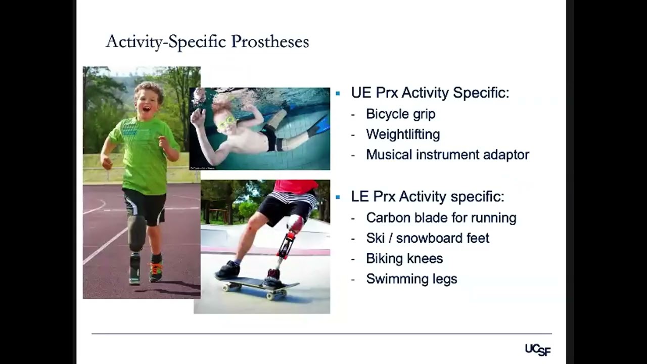 08: Principles of Prosthetic Car for A Child Amputee | Matthew Garibaldi, MS, CPO