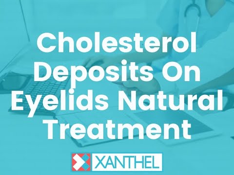 cholesterol deposits on eyelids natural treatment