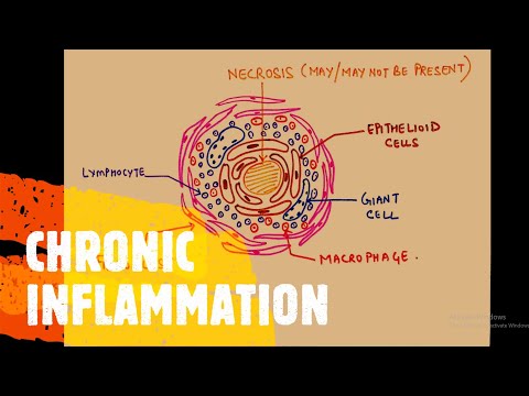 GENERAL PATHOLOGY II CHAPTER 3 II INFLAMMATION REPAIR II GENERAL ASPECTS OF INFLAMMATION II ROBBIN