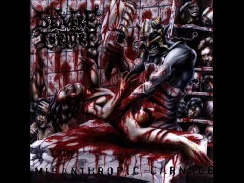 download lagu mp3 mp4 Misanthropic Carnage, download mp3 Misanthropic Carnage free download, download mp3 Misanthropic Carnage