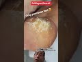 SHAVING CALLUS SLABS Shorts