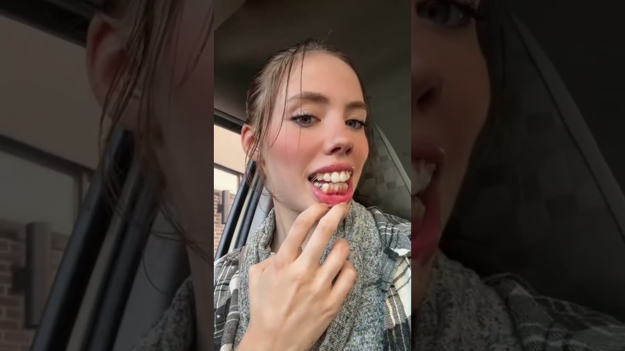 Week 1 to week 11 with invisalign