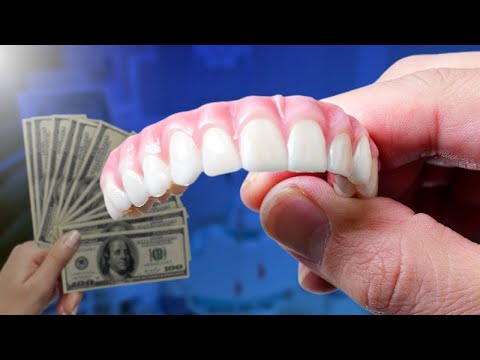 Full Mouth Dental Implant: Cost and Comparison