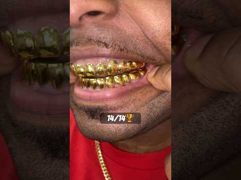 14TOP 14BOTTOM Dental Gold 24K🏆🏆🏆 picked up at our Jacksonville Florida location‼️ #glee #grillz
