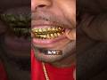 14TOP 14BOTTOM Dental Gold 24K🏆🏆🏆 picked up at our Jacksonville Florida location‼️ #glee #grillz