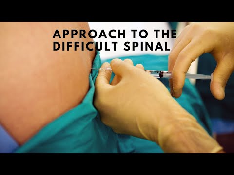 Approach to the difficult spinal