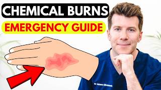 Chemical Burn Explained – Fast Facts for First Aid & Recovery