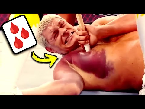 Real Doctor Reacts To Painful WWE Injuries
