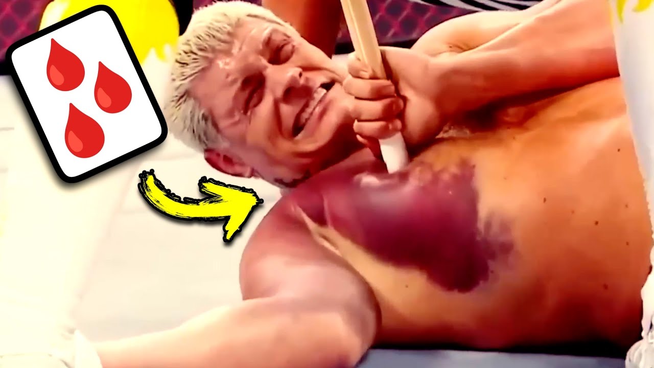Doctor Reacts To Painful WWE Injuries
