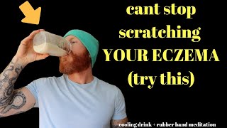 A STRANGE technique for eliminating the desire to SCRATCH your eczema, dermatitis or psoriasis