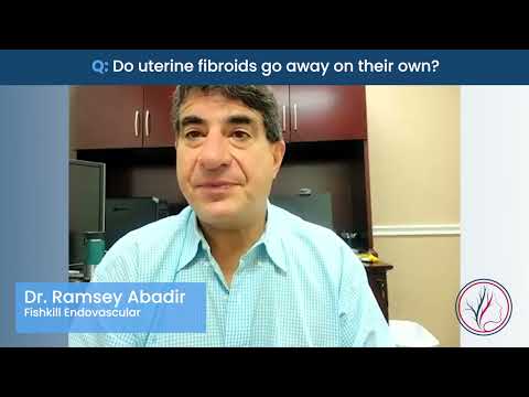 Do Large Fibroids Go Away On Their Own - AFC