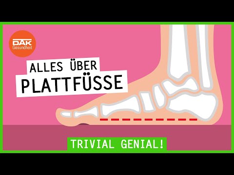 So erkennst du einen Plattfuß! | #trivialgenial | DAK-Gesundheit