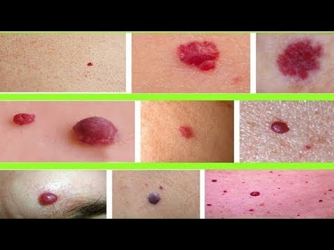 Behandlung von Gelenken auf der Insel Hainan Schmerzen im Nacken an die richtigen Übungen