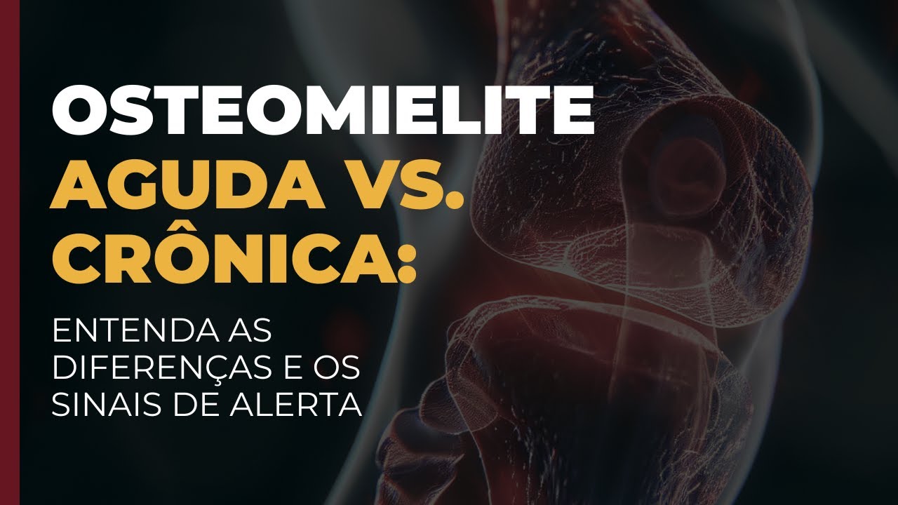 OSTEOMIELITE AGUDA VS CRÔNICA: Diferenças e Sinais de Alerta