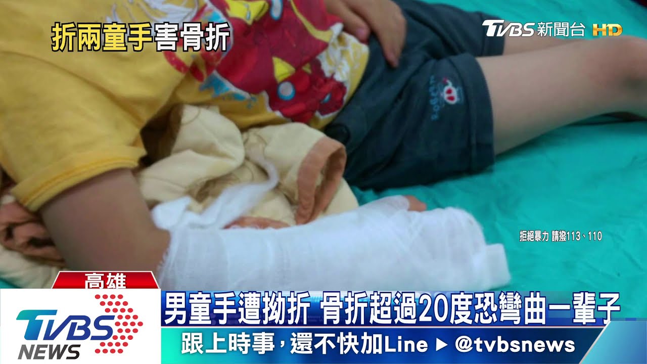 恐怖園長猛拗5歲童手 男童拿湯匙痛得手抖