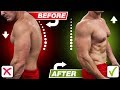 Have Bad Posture? Fix Your