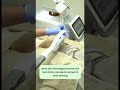Buttock Rejuveniton Bisa Membantumu Mendapatkan Bokong Yang Cerah Serta Dapat Mencegah Jerawat
