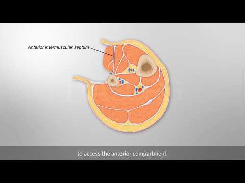 Fibula osteocutaneous flap harvest
