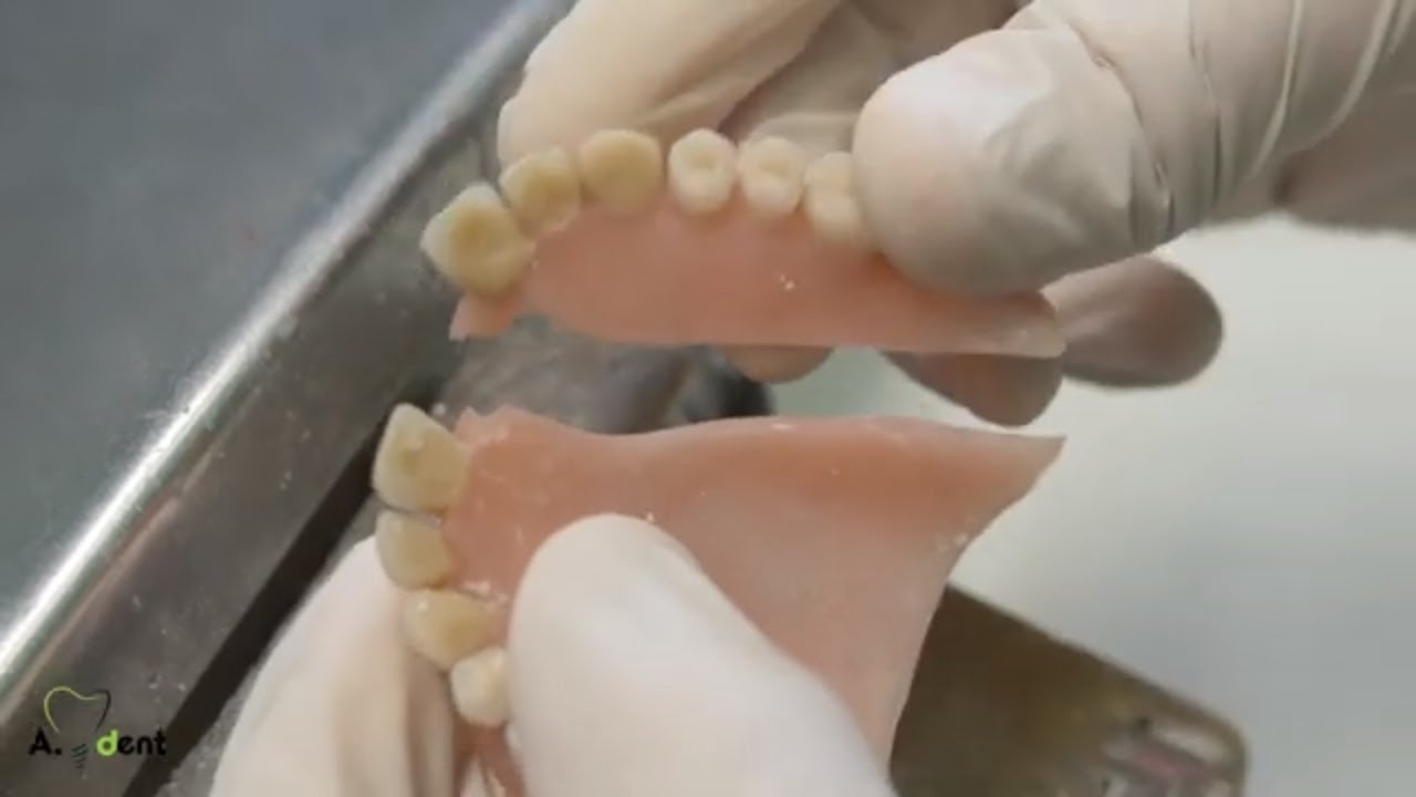 Capitolo 1.2 Riparazione di una protesi totale