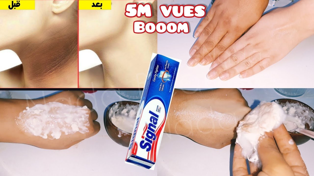 secret japonais pour blanchir la peau en 10 degrés, élimine le mélasma et la pigme ✅