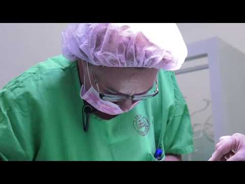 Látás szaruhártya transzplantáció