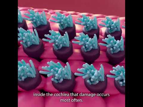 Inside The Ear - How Noise Induced Hearing Loss happens