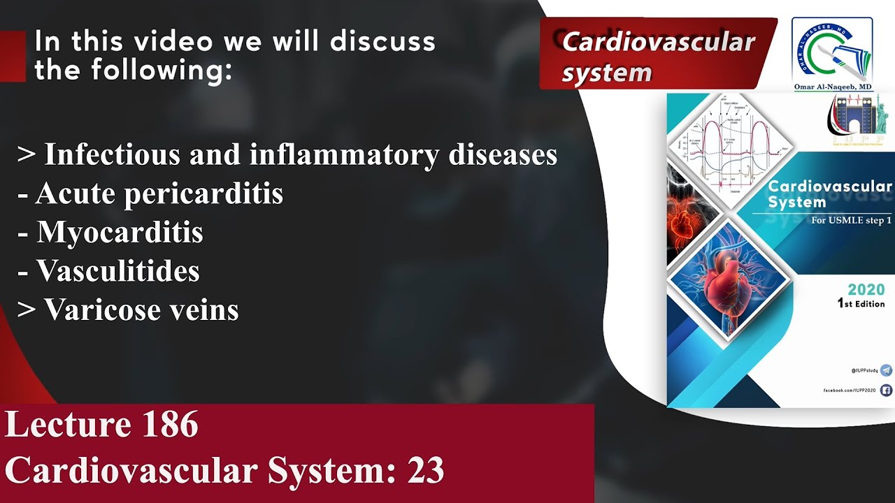 Acute pericarditis | Myocarditis | Vasculitides | Varicose veins