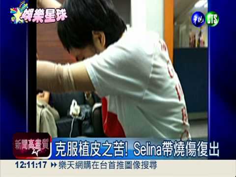 延婚期咬牙復健 Selina浴火重生!