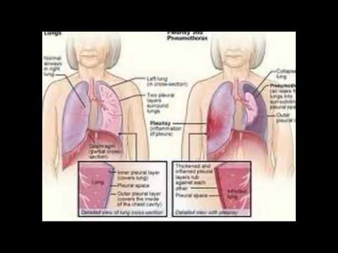 Student Loan, Students Want Loan Forgiveness, Say Schools Defrauded Them