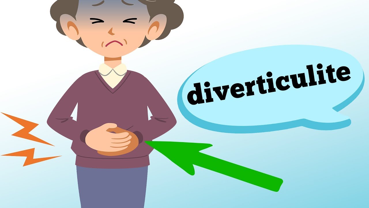 O que é DIVERTICULITE e quais os sintomas?