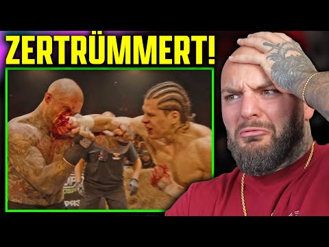 Nose Smashed! Top Dog Boss vs. Alex the Horrible! Ringlife