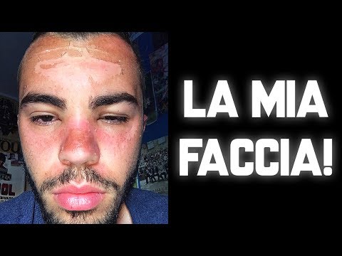 Leliminazione di pigmentary nota in risposte di Belgorod Mesotherapy su decolorazione di pelle