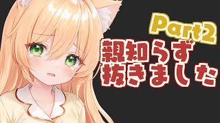 全身麻酔で歯を抜く！Part２【望月のあ】