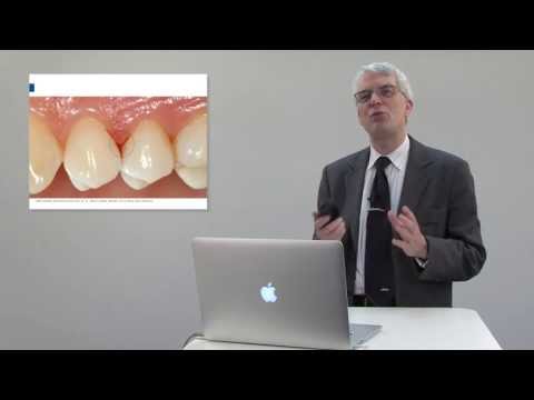 Erysipelas malattia articolare Dolore nella parte bassa della schiena e le gambe in basso