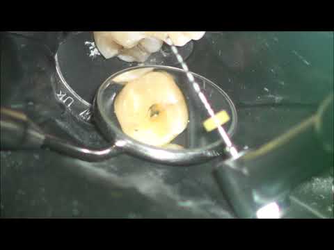 SOCO SC PRO 2018, машинные файлы с контролируемой памятью, 25 мм ассорти (SC Pro 2018) - фото 1 - id-p1087946059