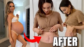 My Belly and Stretch Marks After Having Triplets and Our Fifth Baby | Post Pregnancy Stretch Marks