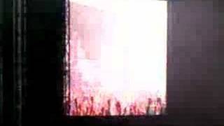 Haemorrhage - I&#39;m A Pathologist