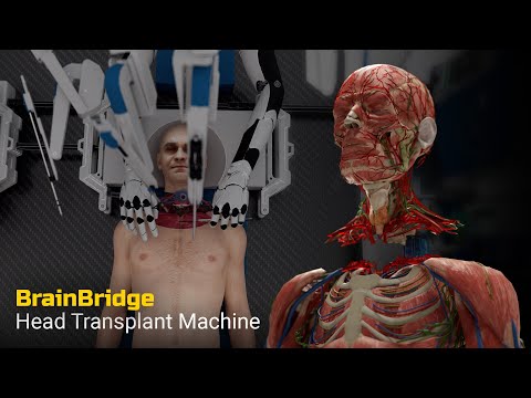 Head Transplant Machine – BrainBridge